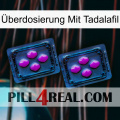 Überdosierung Mit Tadalafil 03